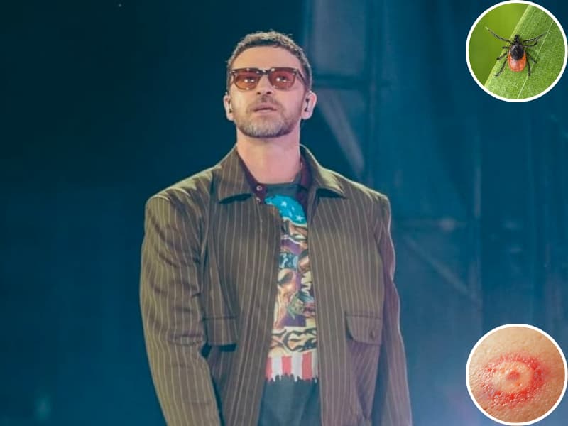 Justin-Timberlake-has-Lyme-Disease